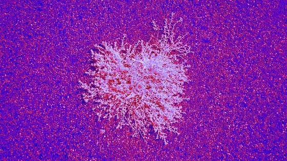 Un algoritmo può identificare le malattie rare?