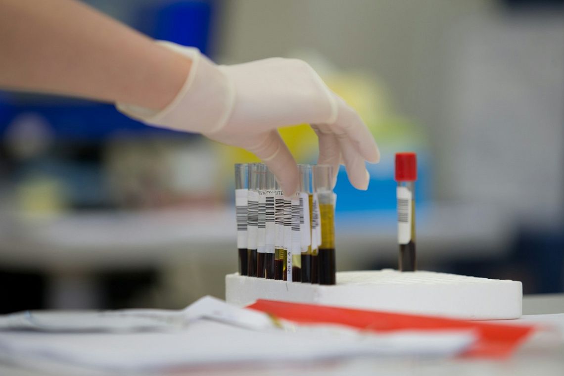 L’oro invisibile: la lunga corsa per creare il sangue più raro del mondo